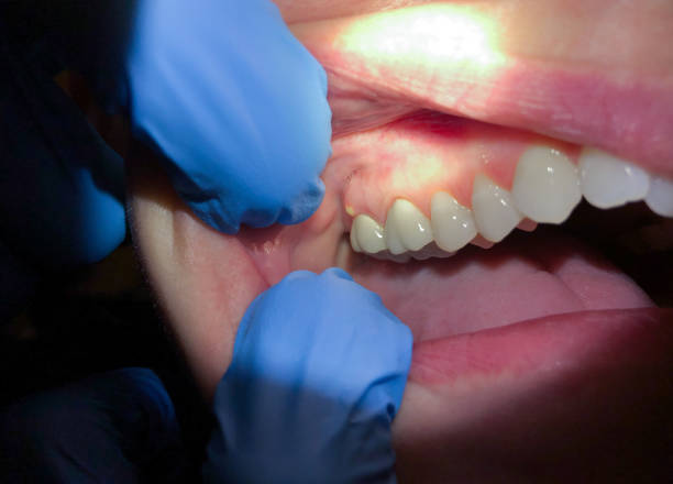 Best Urgent Dental Care for Toothaches in Delta Junction, AK