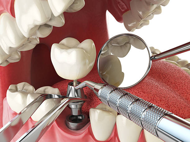 Best Broken or Chipped Tooth Repair in Delta Junction, AK