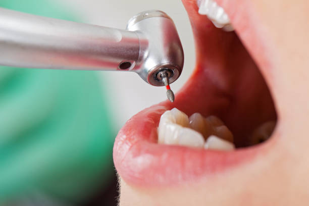 Best Emergency Cosmetic Dentistry (e.g., broken veneers) in Delta Junction, AK